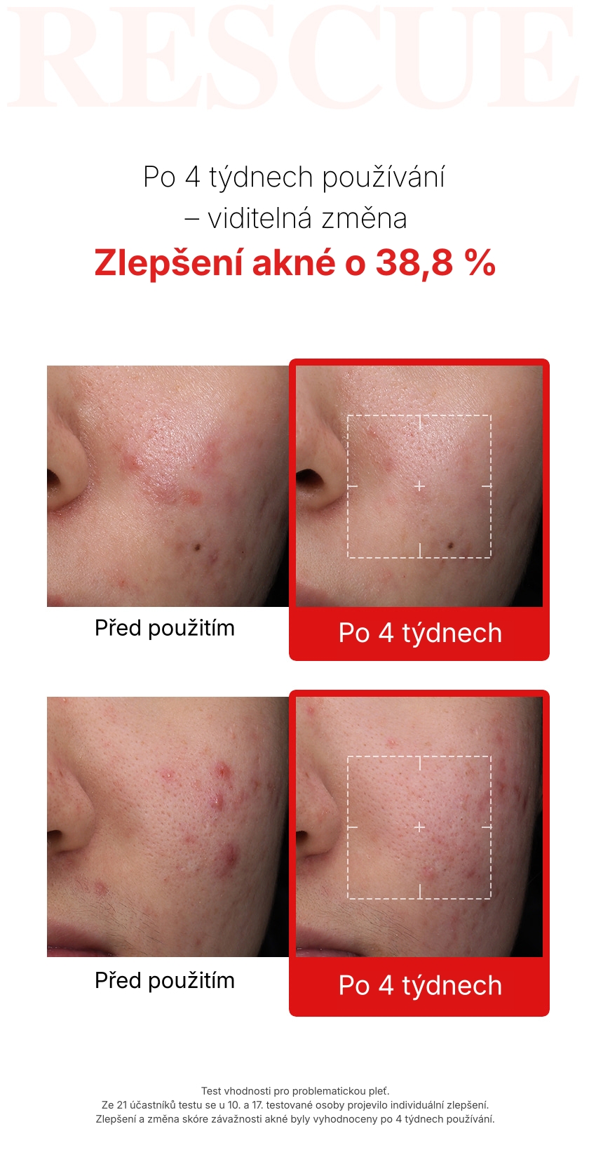 1.2. Detailed Page BARULAB Trouble Rescue Cream